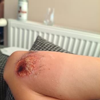 Ahu Hastanesi Acil Servis Hekim İlgisizliği