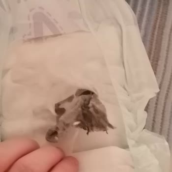 Jenny & Willy Sağlığın Hiçe Sayılması