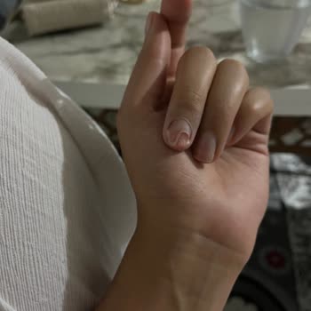 Gratis Kalıcı Oje Yazıldı Ve Tırnağım Enfekte Oldu