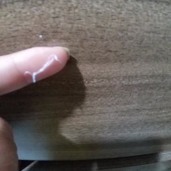 Listerine Listerin Ağız Bakım Suyu Ağız İçinde Soyulma Yapıyor