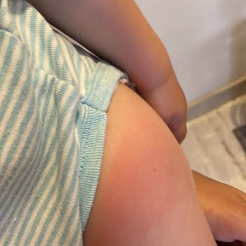 Yeni Yüzyıl Üniversitesi Gaziosmanpaşa Hastanesi Çocuk Doktoru Ve Yanlış İğne!