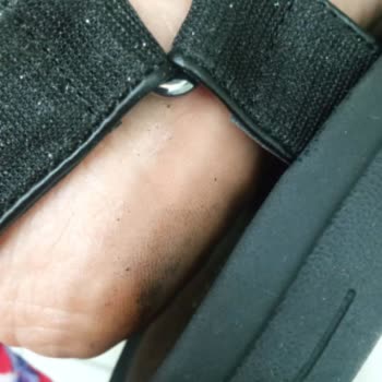 Deichmann Red Cevabı Almamız