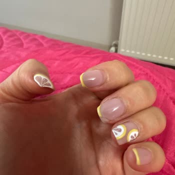 Nailland Ankara Nail Land Ankara Sorunsalı