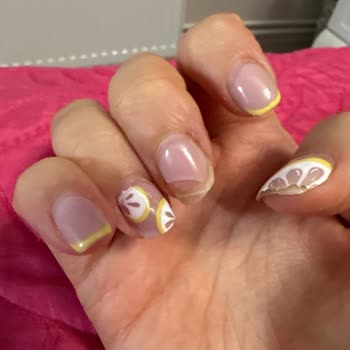 Nailland Ankara Nail Land Ankara Sorunsalı