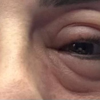 Day2day Collagen Fish Kullandım, Gözlerim Şişti