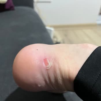 Zara'dan Alınan Hasarlı Ayakkabı