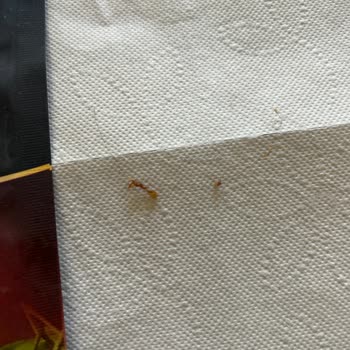 Pınar Et Ve Süt Gurme Burgerden Saç Çıktı