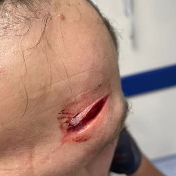 Gp Kompozit Tur Camı Kırılması