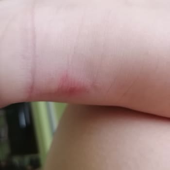 Puma Ayakkabı Yara Yaptı