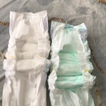 Molfix Bez Sahte Çocuklarım Poposu 1 Gün İçinde Pişik Yara Oldu