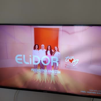 Trendyol Üzerinden Alınan Televizyon Kusurlu Geldi