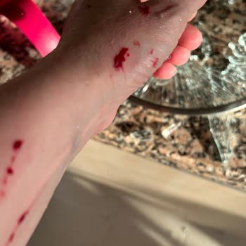 Karaca Züccaciye Cam Kapağın Patlaması