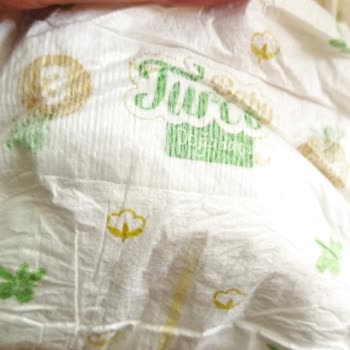 Baby Turco Bebek Bezinde Bilinmeyen Madde