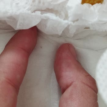 Baby Turco Bebek Bezinde Bilinmeyen Madde