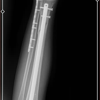 MACfit (Ankara) Macfit Doktor Raporunu Geçersiz Sayması