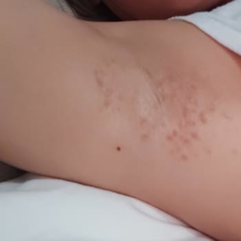 Nivea Derma Control Clinical Kadın Roll-on Deodorant Eşittir Hata