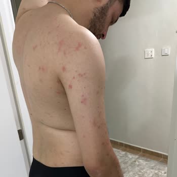 Modalife Dan Aldığımız Yatak Baza Ve Başlıktan Tahta Kurusu Rezilli