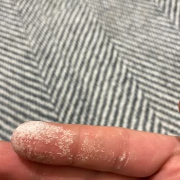 Vanish Kosla Leke Çıkarıcı Elimi Yaktı, Beyaz Beyaz Lekeler Oluştu