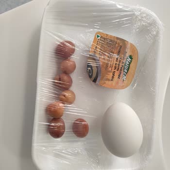 Aksaray Üniversitesi Eğitim Ve Araştırma Hastanesi Çölyak Metabolizma Mağduriyeti