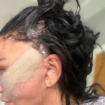 Taş Hospital Ameliyatı Beni Mağdur Etti