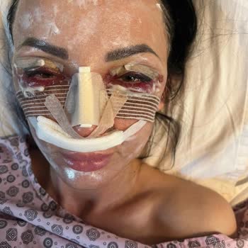 Taş Hospital Ameliyatı Beni Mağdur Etti