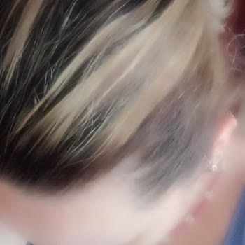 Fatih Zeybek Kuaför ve Güzellik Salonu Yanan Saçlarım Ve Mağduriyetim