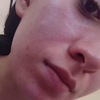 Gratis Himalaya Hafif Nemlendirici Krem