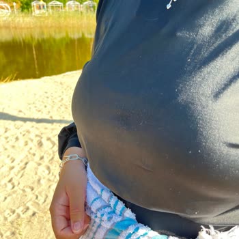 Manuka Mayo Tüylenmesi Ve Yavaş Çözüm Süreci