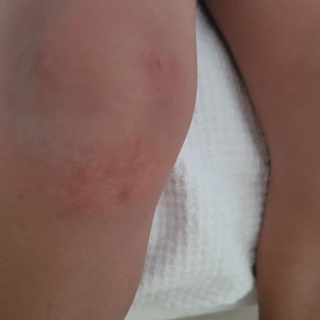 Bayar Family Resort Hotel&SPA Pişmanlığı Param Çöp Oldu