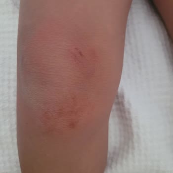 Bayar Family Resort Hotel&SPA Pişmanlığı Param Çöp Oldu