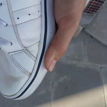 Barçın Spor Adidas Ayakkabı Deforme Olması