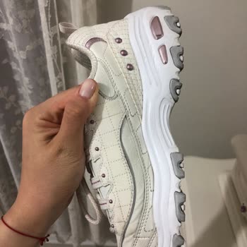 Skechers D'lites Sararma Sorunu Ve Ücret İadesi Sıkıntısı