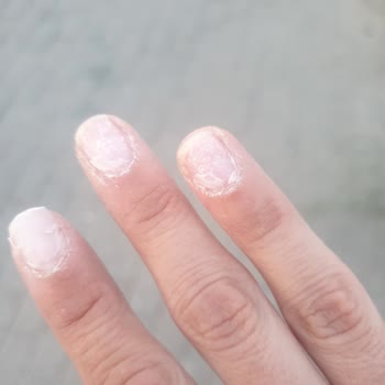 Yasmin & Eleş Beauty Kaba Tavır Kötü İşlem Saygısızlık