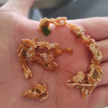 Köfteci Yusuf Zarı Temizlenmeyen Et Sıkıntısı