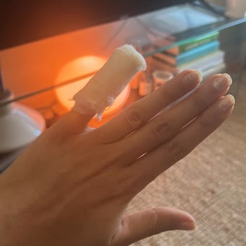 Karaca Züccaciye Tencere Kapağı Kendi Kendine Çatlayıp Elimi Kesti