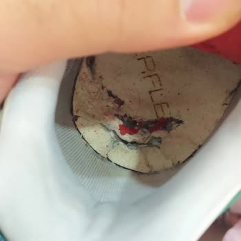 Toksöz Spor Ayakkabımın Yanları Açıldı Ve Tabanı Parçalandı