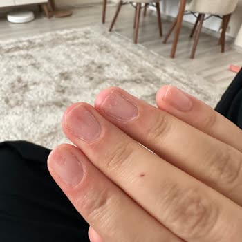 Aymira Koçaklı Yaşam Merkezi Kapsül Tırnak Aymira Koçaklı