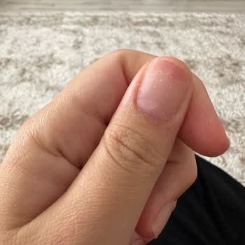 Aymira Koçaklı Yaşam Merkezi Kapsül Tırnak Aymira Koçaklı