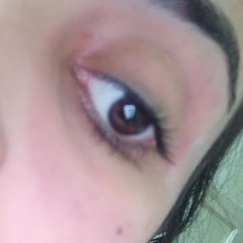 She Vec Cosmetic Göz Altı Serumu Gözümün Altını Yaktı