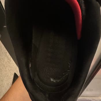 Skechers Ayakkabı 5 Ayda Deforme Oldu