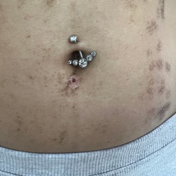 Estetik International Randevu Süreci Zorluğu ve Hatalı İşlem