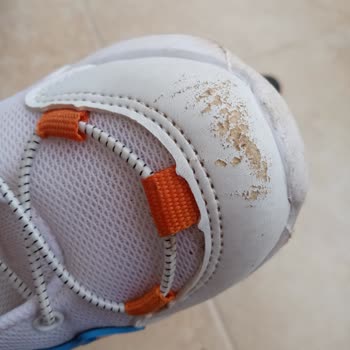 Vicco Fabrikası Hatasını Kabul Etmiyor