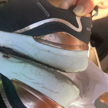 Skechers Forum Bornova 1 Aylık Ayakkabıda Gold Detayında Yeşerme