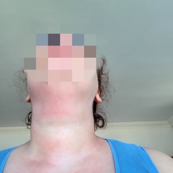 Loreal Paris Kırışıklık Karşıtı 30+