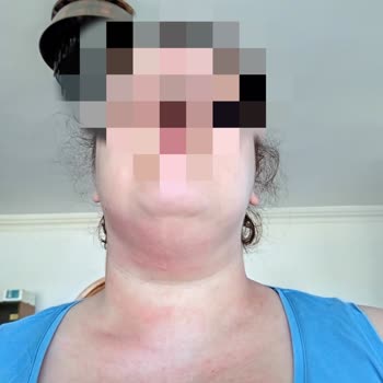 Loreal Paris Kırışıklık Karşıtı 30+