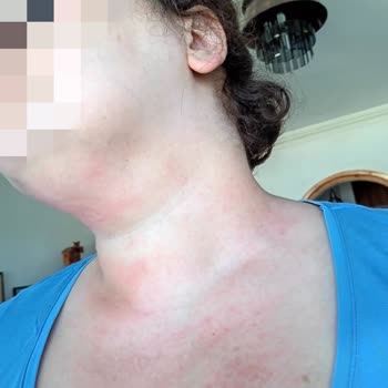 Loreal Paris Kırışıklık Karşıtı 30+