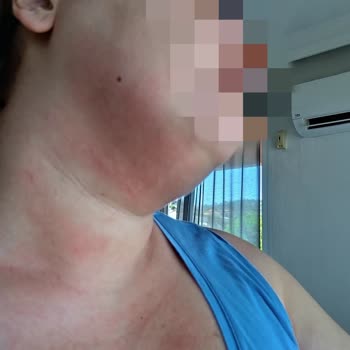 Loreal Paris Kırışıklık Karşıtı 30+