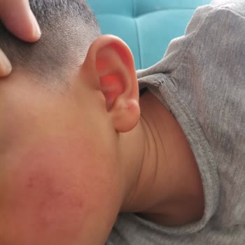 Dalin Likit Pudra Bebekler İçin Üretilmiş Fakat Kıpkırmızı Yaptı