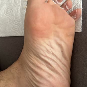 Watsons Ayak Maskesi & Ayak Peelingi ; Mjcare Miracle Foot Asla İşe Yaramıyor