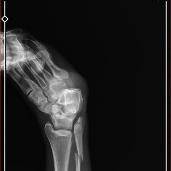 Ordu Medical Park Hastanesi Yanlış Tedavi